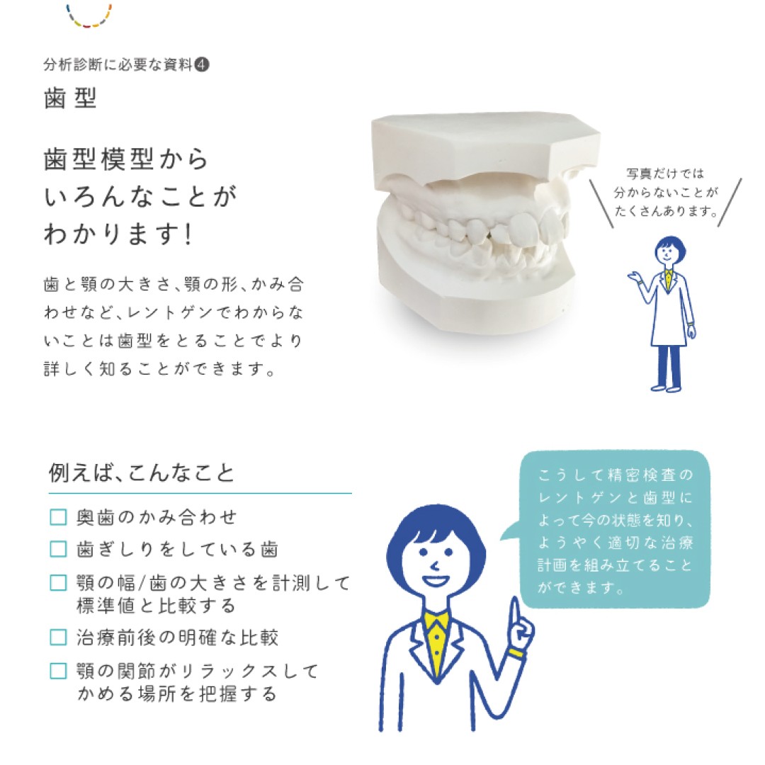 矯正治療に必要な歯型模型 | モンテ矯正歯科クリニック｜まちの